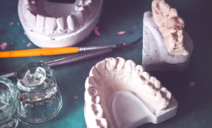 Pose de prothèse dentaire complète amovible dans Lanaudière - Denturologiste Sylvain Perreault à Joliette