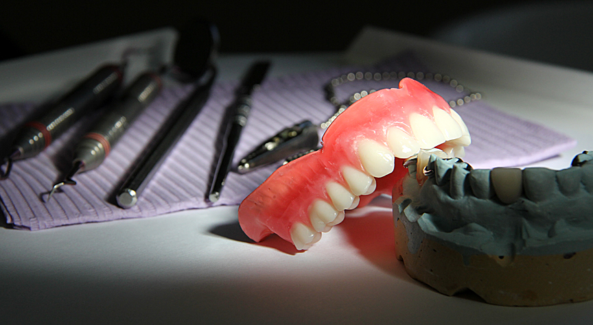Pose de prothèse dentaire complète amovible à Joliette et ses environs - Denturologiste Sylvain Perreault à Joliette
