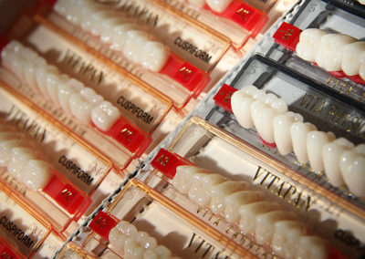 Prothèse dentaire complète amovible dans Lanaudière- Denturologiste Sylvain Perreault à Joliette