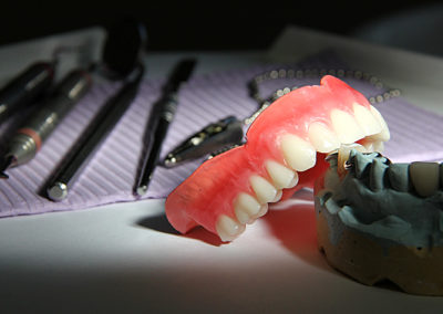 Prothèse dentaire dans Lanaudière - Denturologiste Sylvain Perreault à Joliette